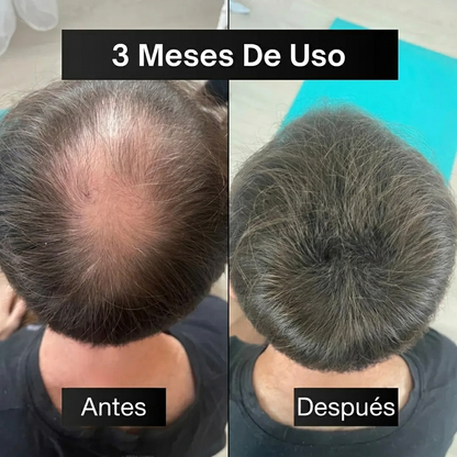 Sérum Anticaída y Crecimiento Capilar